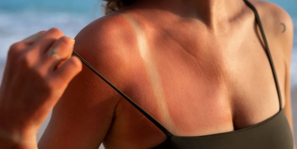 Bronze Maceió: Onde Encontrar o Melhor Bronze na Capital Alagoana